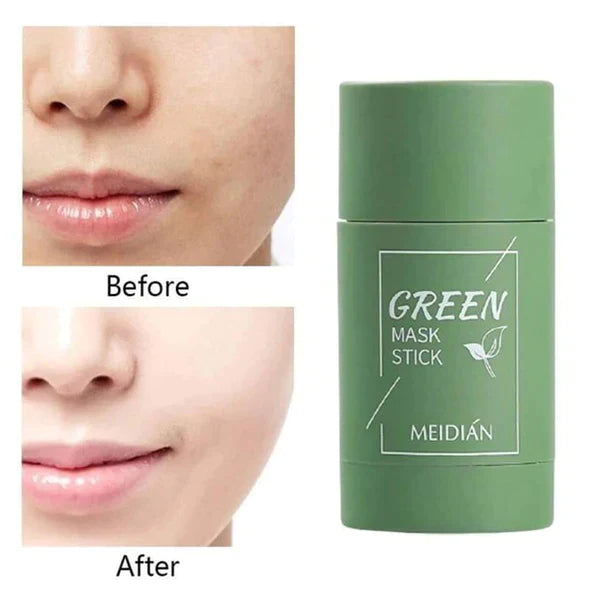 Fivfivgo™ Green Tea Detox Purifying Mask