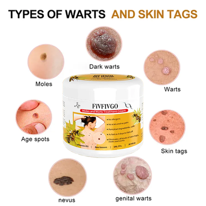 Fivfivgo™ Bee Venom Mole and Wart Treatment Cream