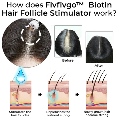 Fivfivgo™  Biotin Hair Follicle Stimulator
