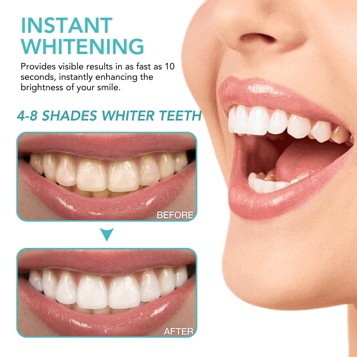 Fivfivgo™ Instant Teeth Whitening Paint