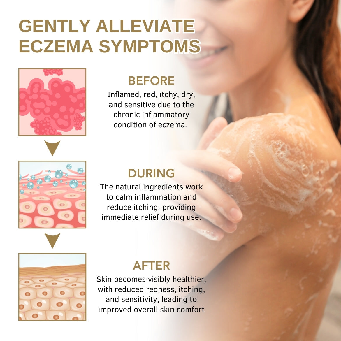 Fivfivgo™ Eczema Herbal Shower Gel