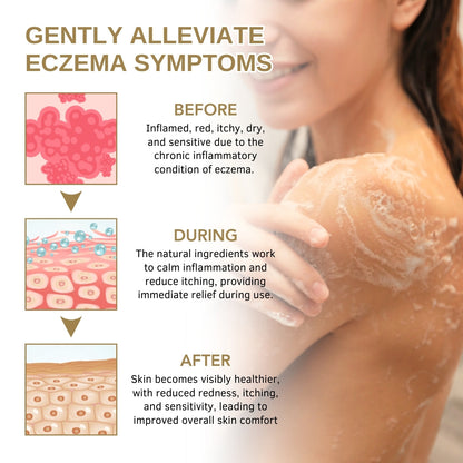 Fivfivgo™ Eczema Herbal Shower Gel